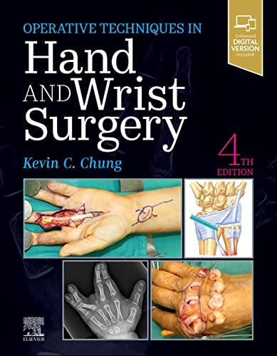 Operative Techniques: Hand and Wrist Surgery, 4th Edition (Videos, Well-organized)