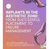 Implants-in-the-Aesthetic-Zone-From-Successful-Placement-to-Failure-Management-2025