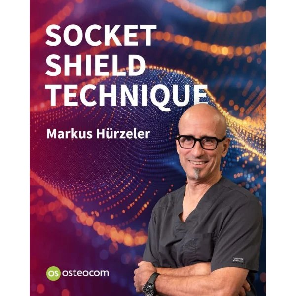 Osteocom – Socket Shield Technique 2025