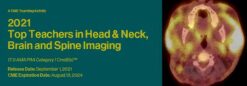 2021 Top Teachers in Head & Neck, Brain and Spine Imaging