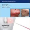 Complications In Minimally Invasive Facial Rejuvenation: Prevention And Management (EPUB)