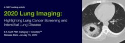 2020 Lung Imaging Highlighting Lung Cancer Screening and Interstitial Lung Disease