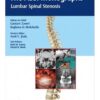 The ASSI Monographs-Lumbar Spinal Stenosis