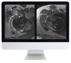 ARRS Controversies In Hip And Pelvis Imaging 2016 (CME VIDEOS)