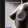 Breast Augmentation Video Atlas, 2nd Edition (EPUB)