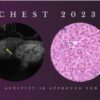 Chest Imaging 2023 CME science course
