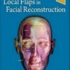 Local Flaps in Facial Reconstruction, 4th Edition (PDF & Videos)