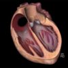 MRI Online Mastery Series: Fundamentals of Cardiac MRI 2021