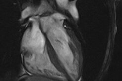 MRIOnline Mastery Series: Cardiac MRI of Non-Ischemic Cardiomyopathy 2021