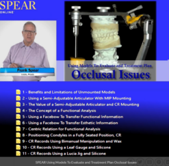 SPEAR Using Models To Evaluate and Treatment Plan Occlusal Issues – Frank Spear