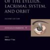 Surgery of the Eyelid, Lacrimal System, and Orbit (Ophthalmology Monograph Series)