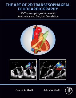 The art of 2D transesophageal echocardiography 2024