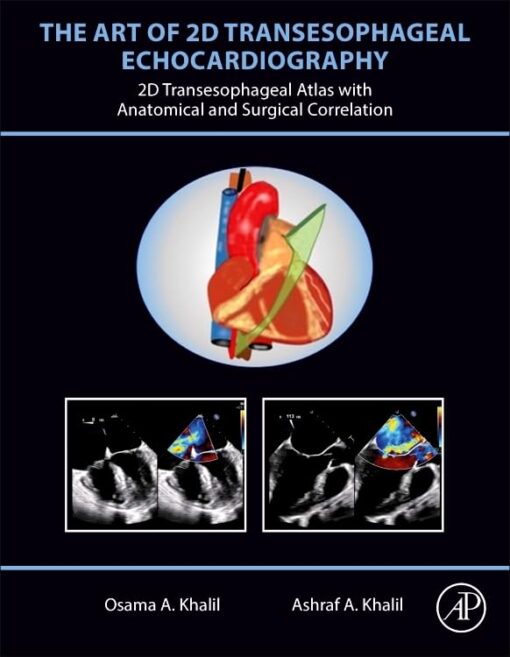 The art of 2D transesophageal echocardiography 2024