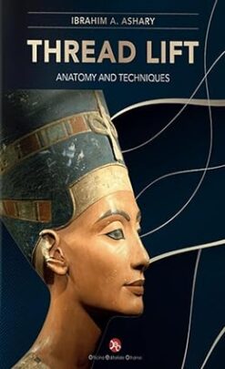 Thread lift Anatomy and techniques 2023