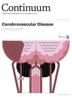 CONTINUUM Lifelong Learning in Neurology April 2023, Volume 29, Issue 2 (PDF Book)