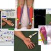 EMG/NCS Online Series: Volume III Sensory Nerve Conduction Studies