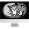 ARRS Gastrointestinal Imaging Online Course 2019 (CME VIDEOS)