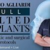 Full tilted implants Prosthetic and Surgical protocols 2023