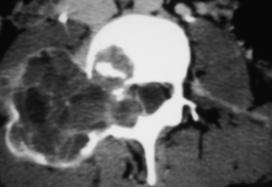 MRI Mastery Series: Degenerative Joint Disease (DJD) 2020