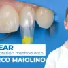 OHI-S Bioclear Dental Restoration Method With Dr. Marco Maiolino