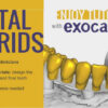 Digital Hybrids for Dentists & Technicians