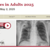 harvard Infectious Diseases in Adults 2025