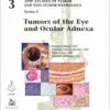 Tumors of the Eye and Ocular Adnexa (AFIP Atlas of Tumor and Non-Tumor Pathology, Series 5, Fascicle 3) (Original PDF from Publisher)