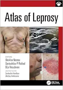Atlas of Leprosy (Original PDF from Publisher+Videos)