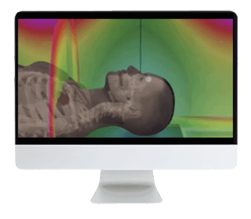 ARRS Understanding MR Safety Through AI Software Simulation 2021
