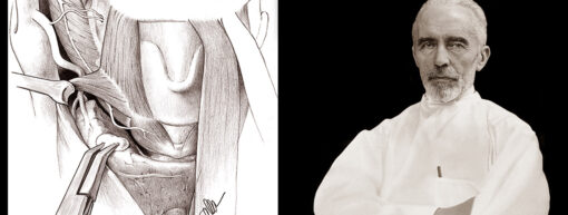 Harvard Surgery of the Thyroid and Parathyroid Gland 2022