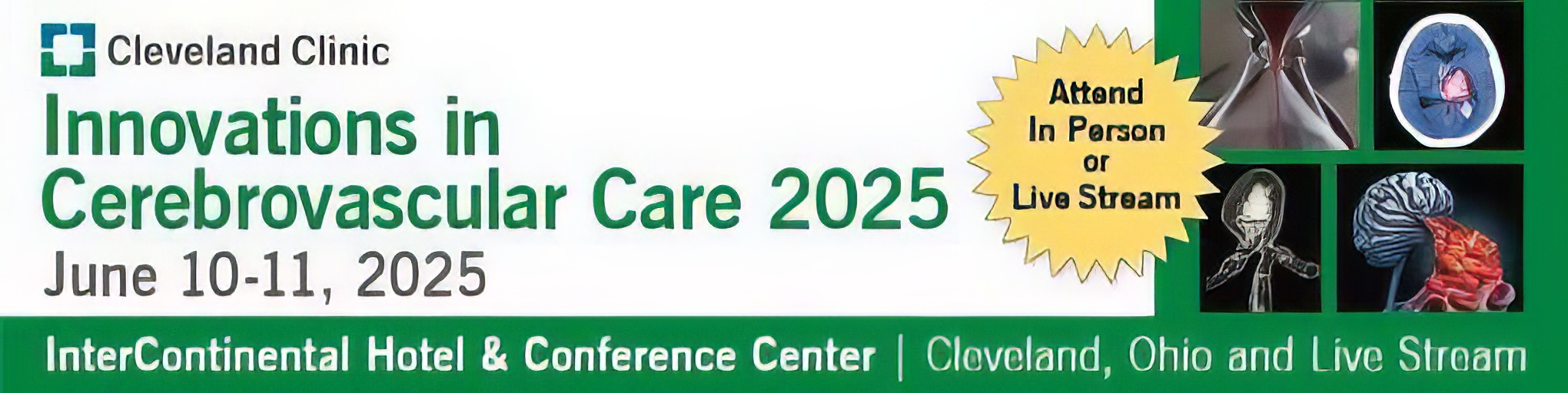 Cleveland Clinic Innovations in Cerebrovascular Care 2025
