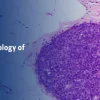 Breast Pathology – The Pathology of Neoplastic Diseases 2025 (Videos with subtitles + Slides)
