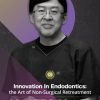 innovations-in-endodontics-the-art-of-non-surgical-retreatment-optimizing-endodontic-retreatment