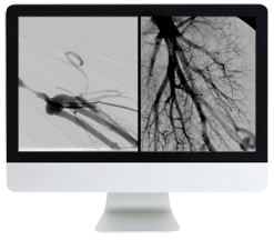 ARRS Case Review of Vascular and Interventional Radiology 2023 (Videos)