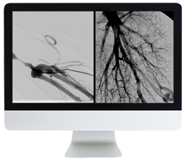 ARRS Case Review of Vascular and Interventional Radiology 2023 (Videos)