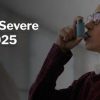 Harvard Update on Severe Asthma 2025